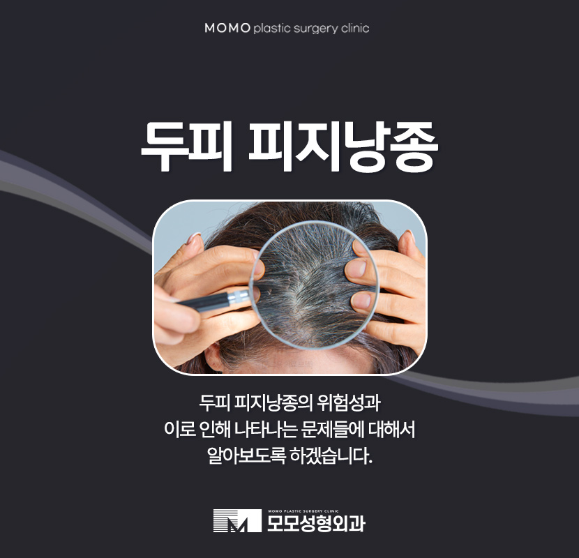 두피 피지낭종으로 인해 발생할 수 있는 문제들 관련 이미지 1