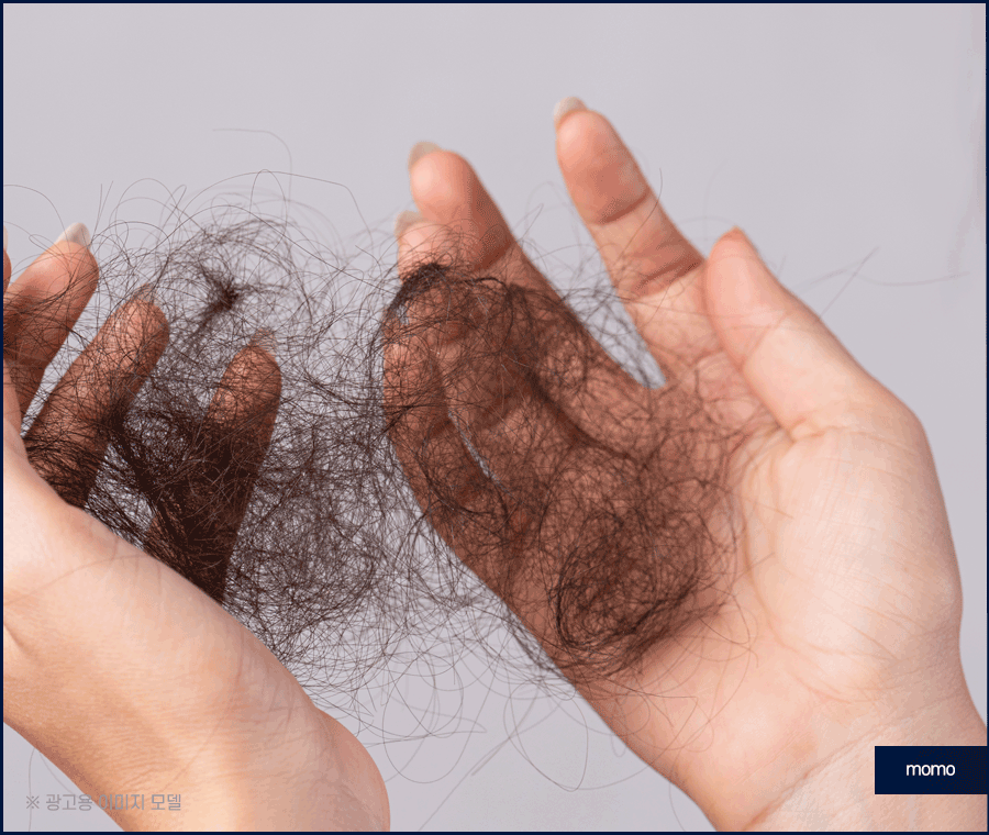 중학생탈모 발생 원인 및 보완하는 방법은? 관련 이미지 2