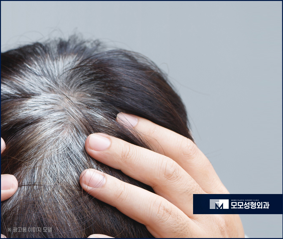 새치 뽑으면 생기는 문제 및 관리 방법까지 관련 이미지 7