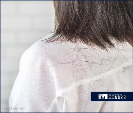 머리심는비용 비절개가 선호되는 이유에 대해 관련 이미지 4