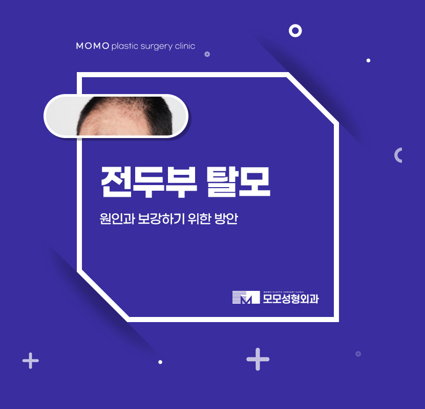 전두부탈모 원인과 보강하기 위한 방안 관련 이미지 1