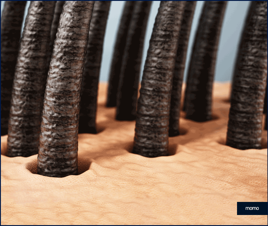 여자 측두부 탈모 아름다운 옆모습을 만드는 방법 관련 이미지 8