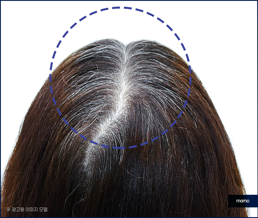 새치나는이유부터 뽑지 말아야 할 이유까지 관련 이미지 5