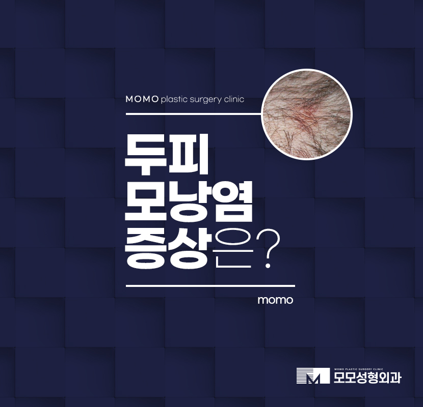 두피모낭염증상 원인을 알고 대처하는 관련 이미지 1