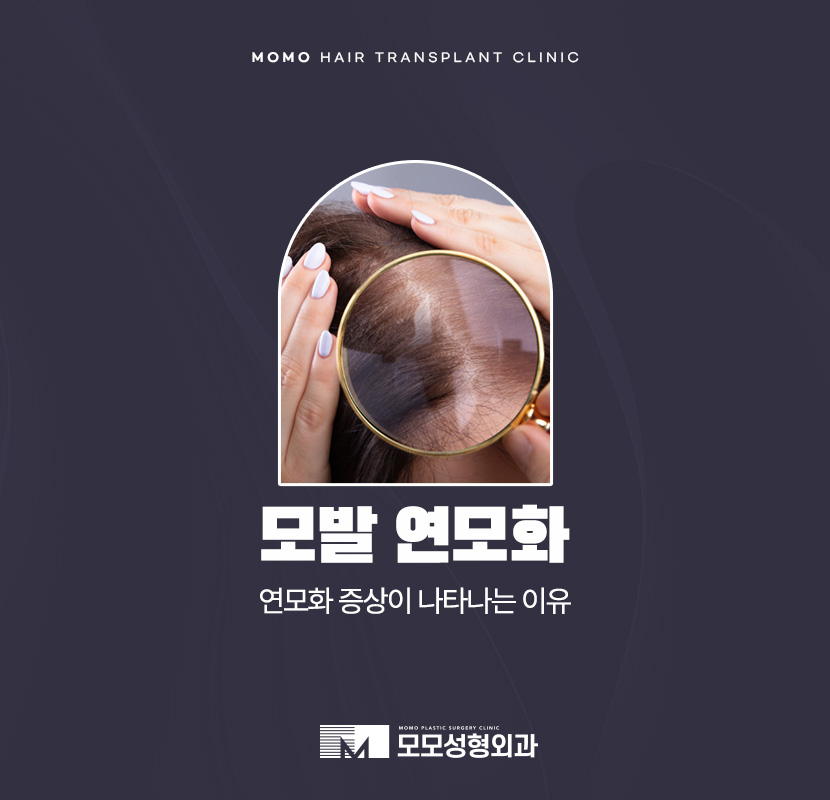 연모화 증상 원인과 방치에 대한 위험성까지 관련 이미지 1