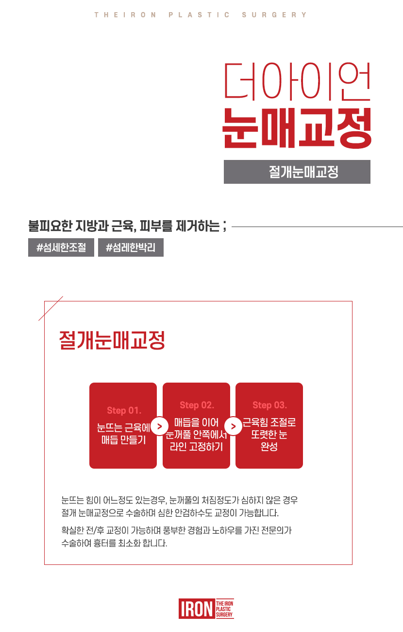 강남 눈매교정 효과를 톡톡히 보기 위한 관련 이미지 8