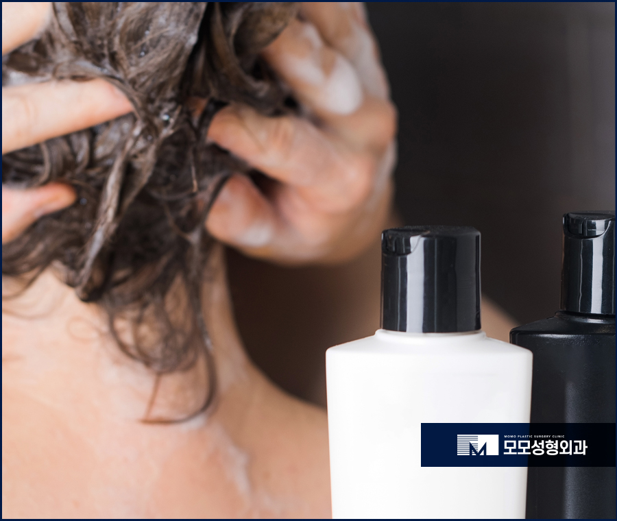 모발이식2달 차에 일어나는 달라짐에 대해서 관련 이미지 9