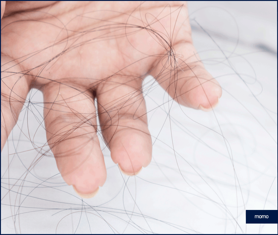 헤어라인 모발이식 비용보다 꼼꼼히 알아볼 조건은? 관련 이미지 2