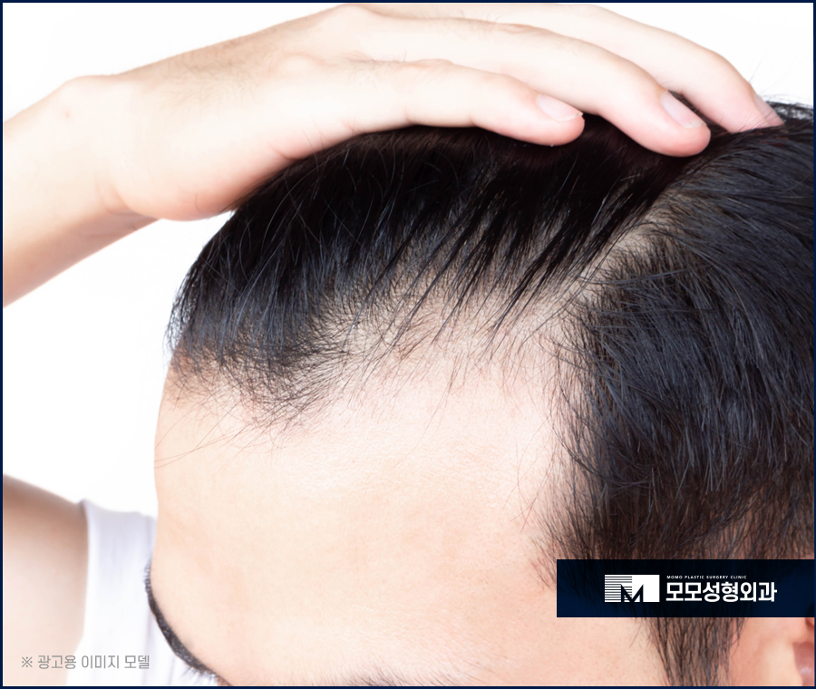 압구정모발이식병원 우수한 결과를 기대한다면 관련 이미지 3