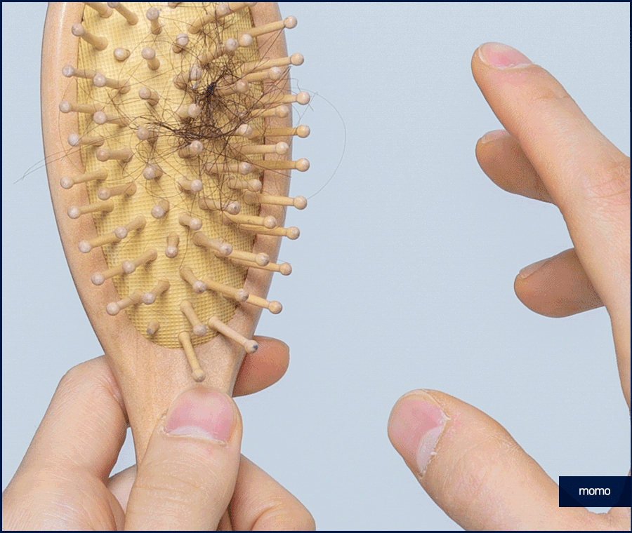 앞머리 모발이식 비용 개인에 따라 달라지는 이유 관련 이미지 3