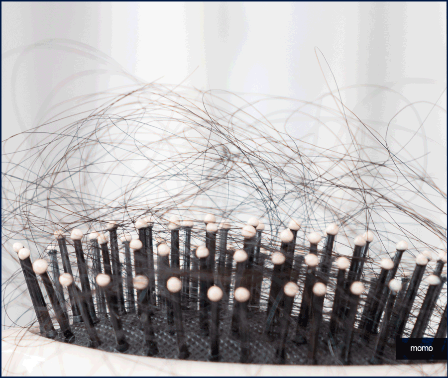 탈모약 처방 및 주의사항, 회복을 위한 대안 관련 이미지 4