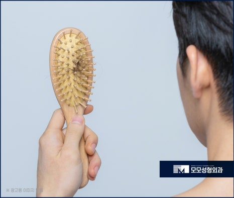 머리심는비용 비절개가 선호되는 이유에 대해 관련 이미지 2