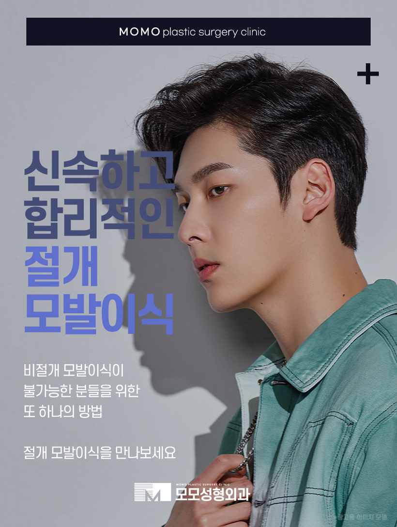 M자탈모병원 깊이 파인 헤어라인이 고민일 경우 관련 이미지 8