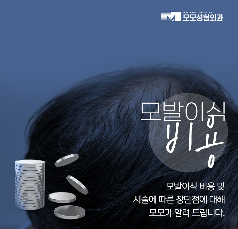 머리심기 비용 및 시술별 장단점 알아보기 관련 이미지 1