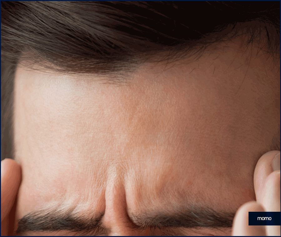 압구정 모발이식 세심한 사전 진단부터 시작하는 곳 관련 이미지 4