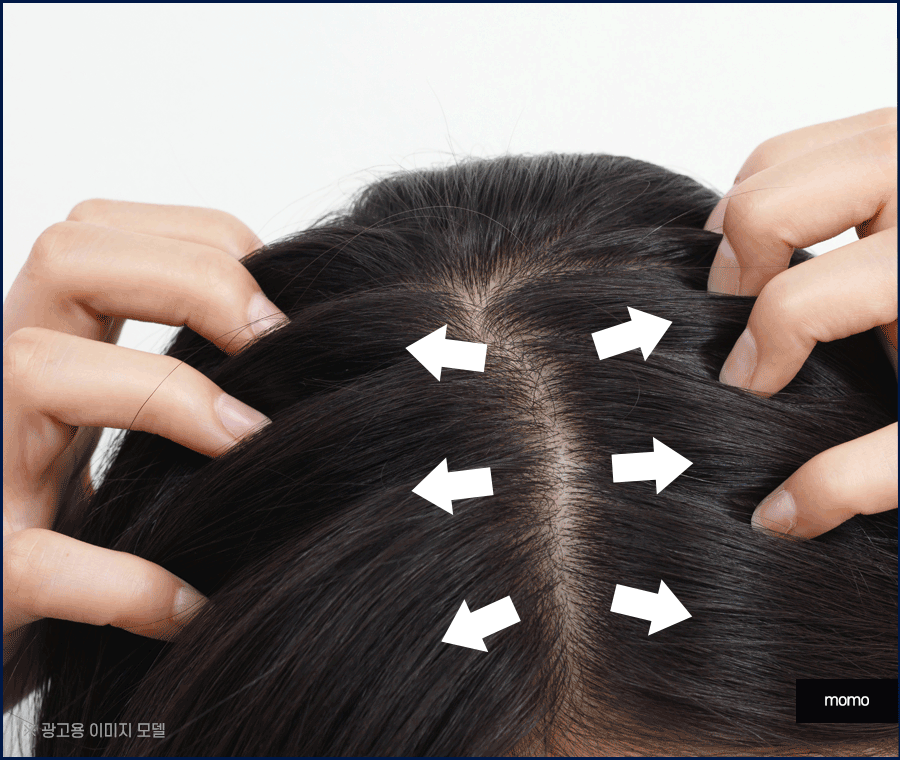 산후 탈모 언제까지 유지되는지 원인 및 대처법 관련 이미지 8