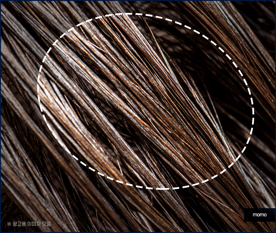 두피피딱지 원인 및 올바른 케어 방법은? 관련 이미지 2