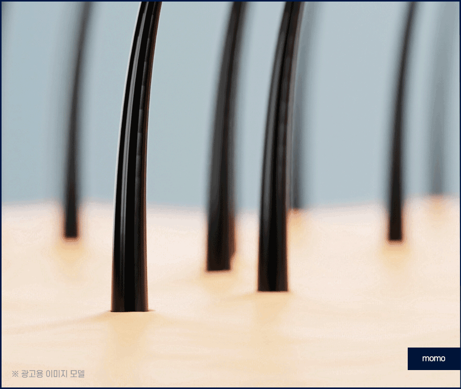 모발이식 생착률 높이기 위한 솔루션은 관련 이미지 15