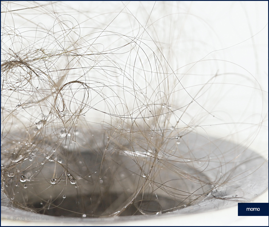 모발이식잘하는곳 찾는 결정적인 기준 관련 이미지 2