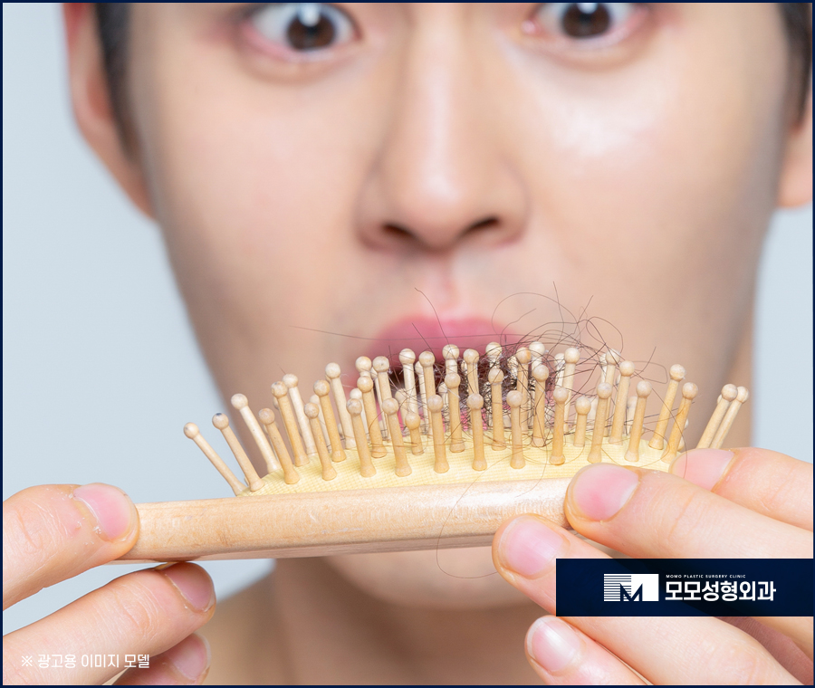모발이식3000모 만족스러운 결과를 위해 관련 이미지 4