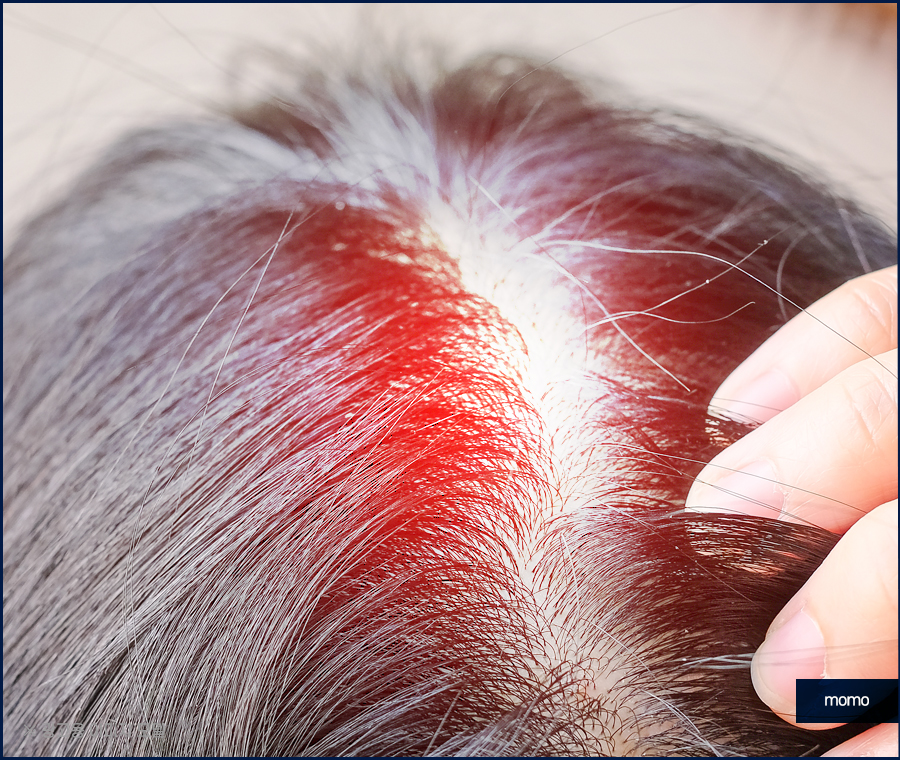 정수리 냄새 원인과 제거하기 위한 방법은 관련 이미지 4