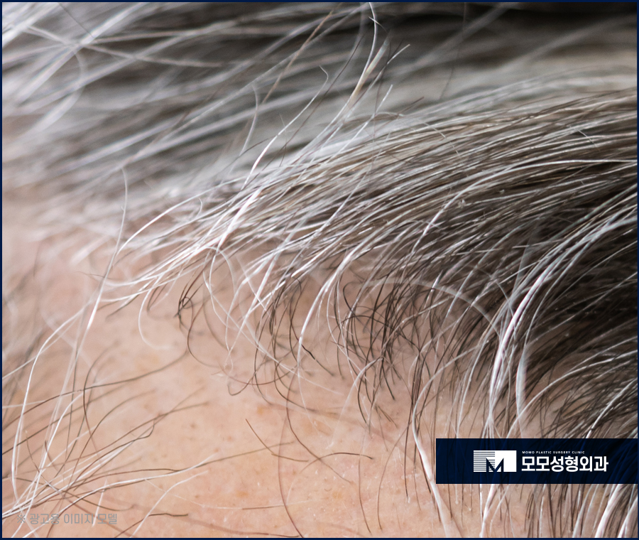 흰머리나는시기와 이유에 대해서 알아봅니다 관련 이미지 4