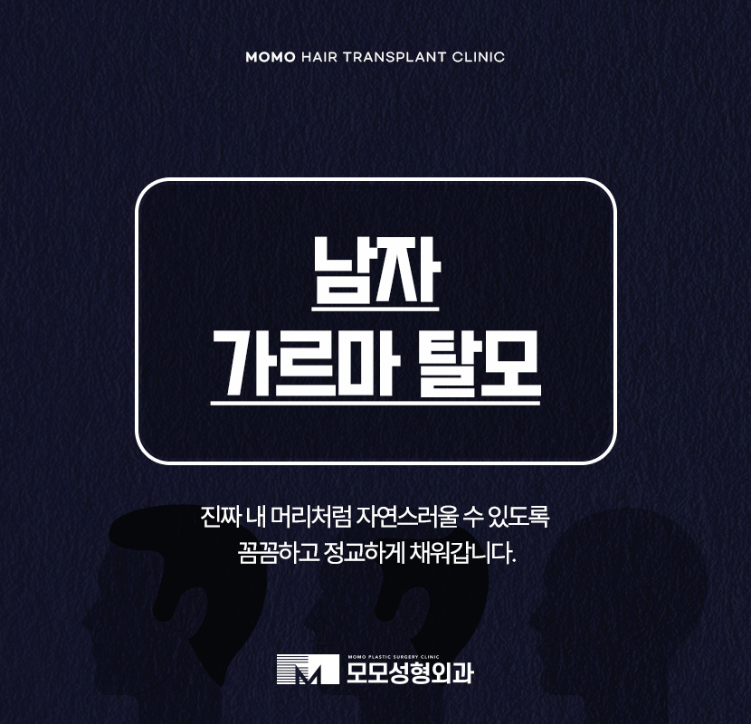 남자 가르마 탈모 진짜 내 머리처럼 채우려면 관련 이미지 1