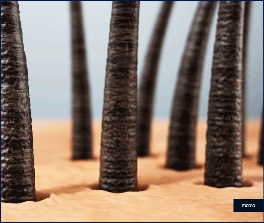 남자헤어라인모발이식 디자인의 중요성 관련 이미지 2