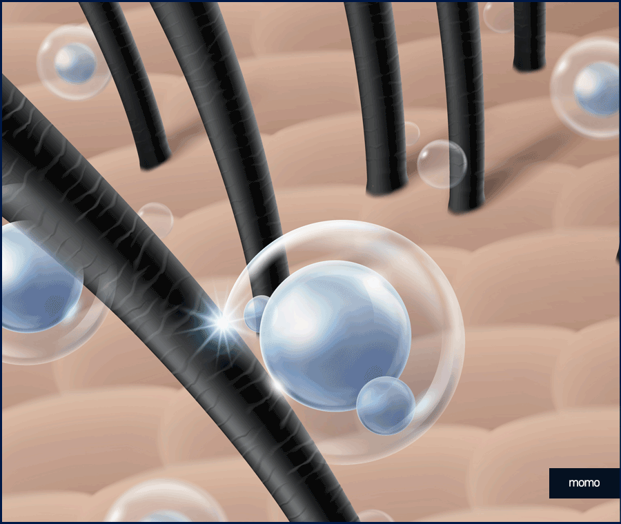 전두탈모 원인 보강을 위한 현명한 선택은? 관련 이미지 4