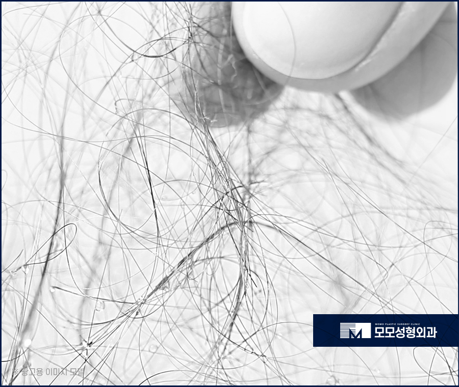 압구정 모발이식 안정적인 생착을 만드는 관련 이미지 6
