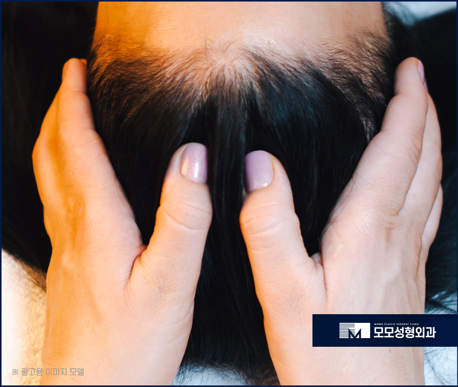 머리빨리기르는법 효과적인 방안은 관련 이미지 14