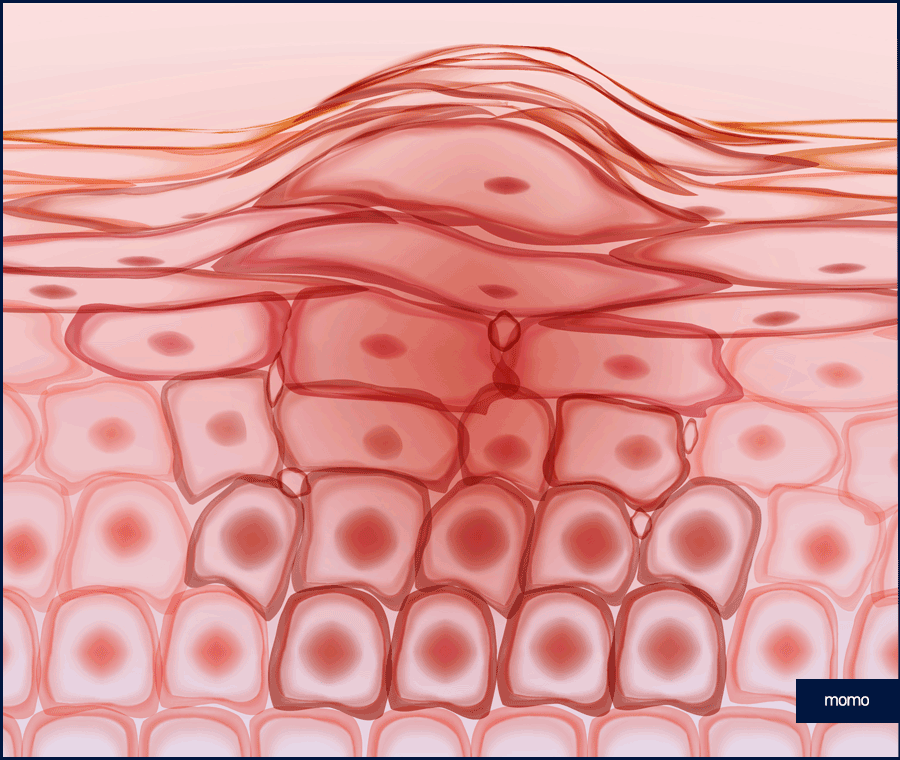 두피피딱지 원인 및 올바른 케어 방법은? 관련 이미지 7
