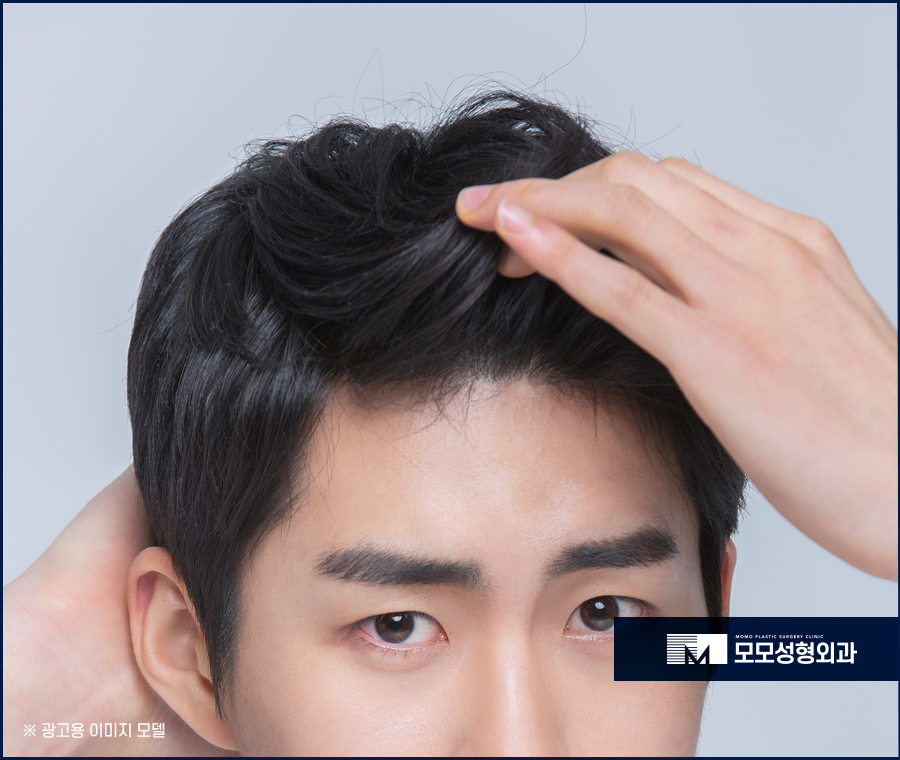 20대남성탈모 성공적인 모습을 중점으로 관련 이미지 9