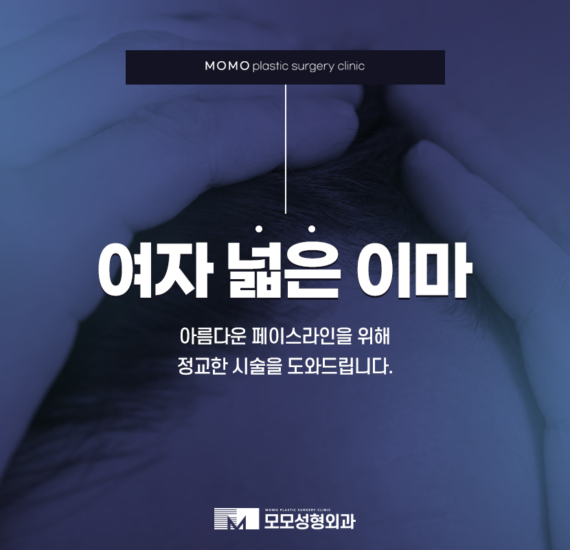 여자넓은이마 고민으로 부터 벗어나는 관련 이미지 1