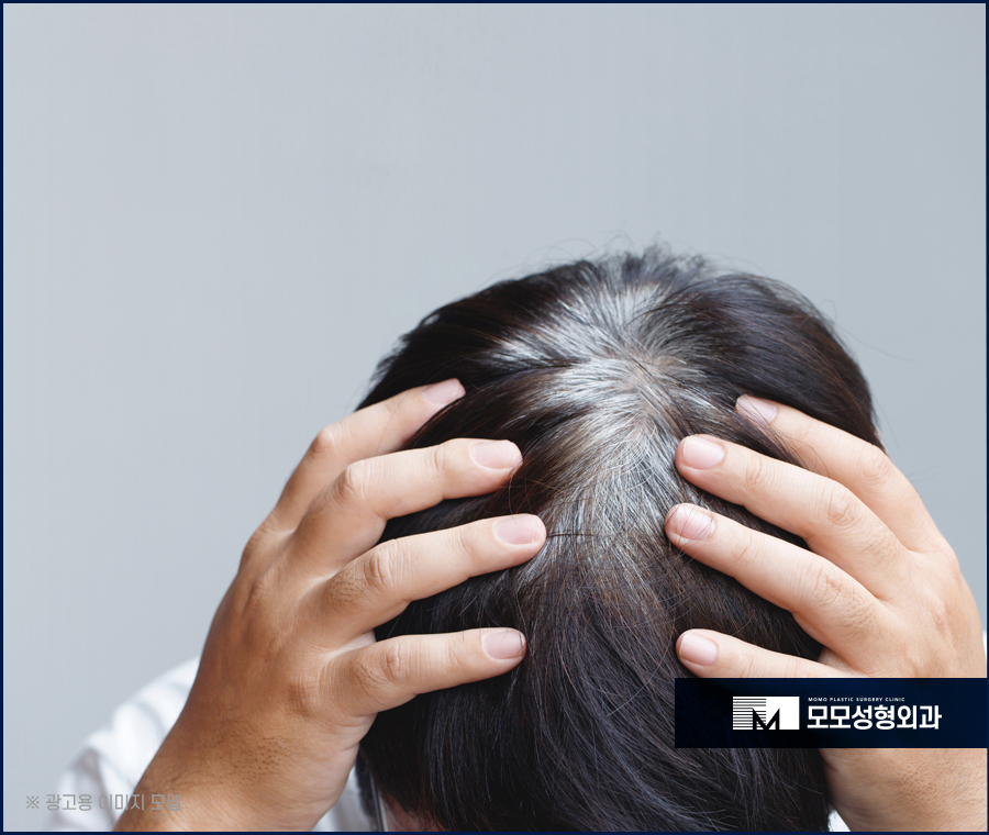 새치 흰머리 차이와 가볍게 잘라내야 하는 이유 관련 이미지 4