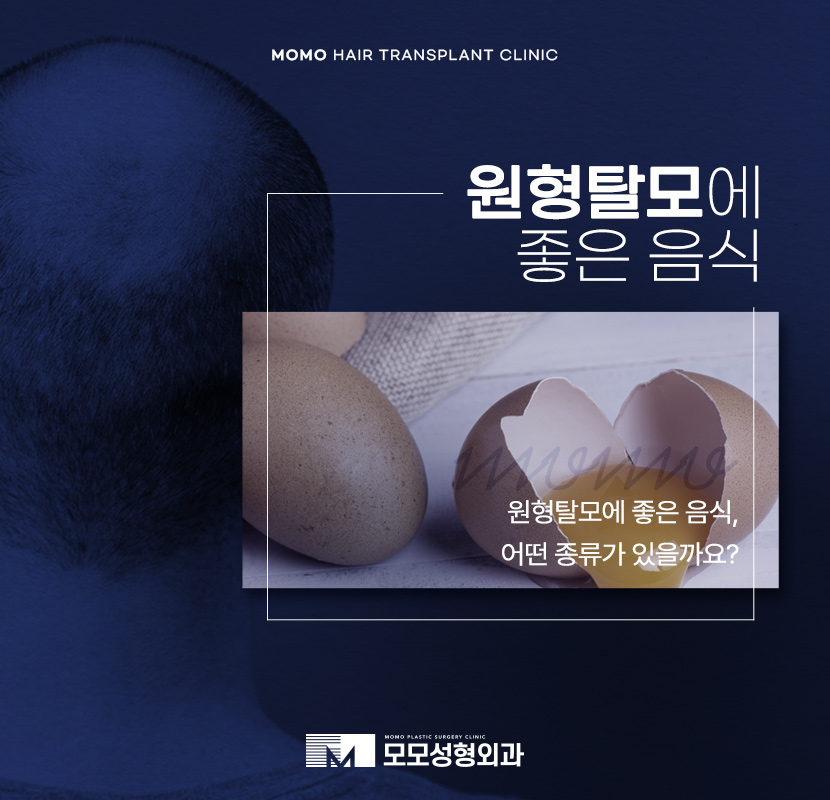 원형탈모에 좋은 음식 고민이라면 꼭 먹기 관련 이미지 1