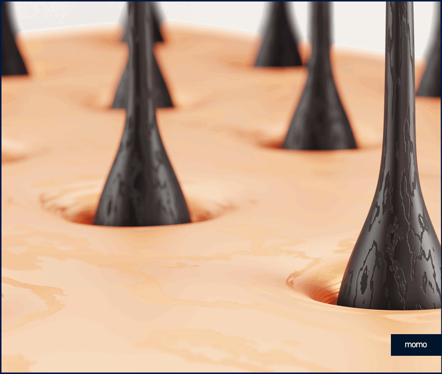 모발이식 금액 개인마다 차이가 나는 이유 관련 이미지 4