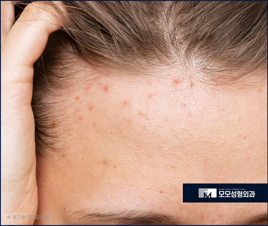 머리안감으면탈모 나타나게 될까 관련 이미지 9