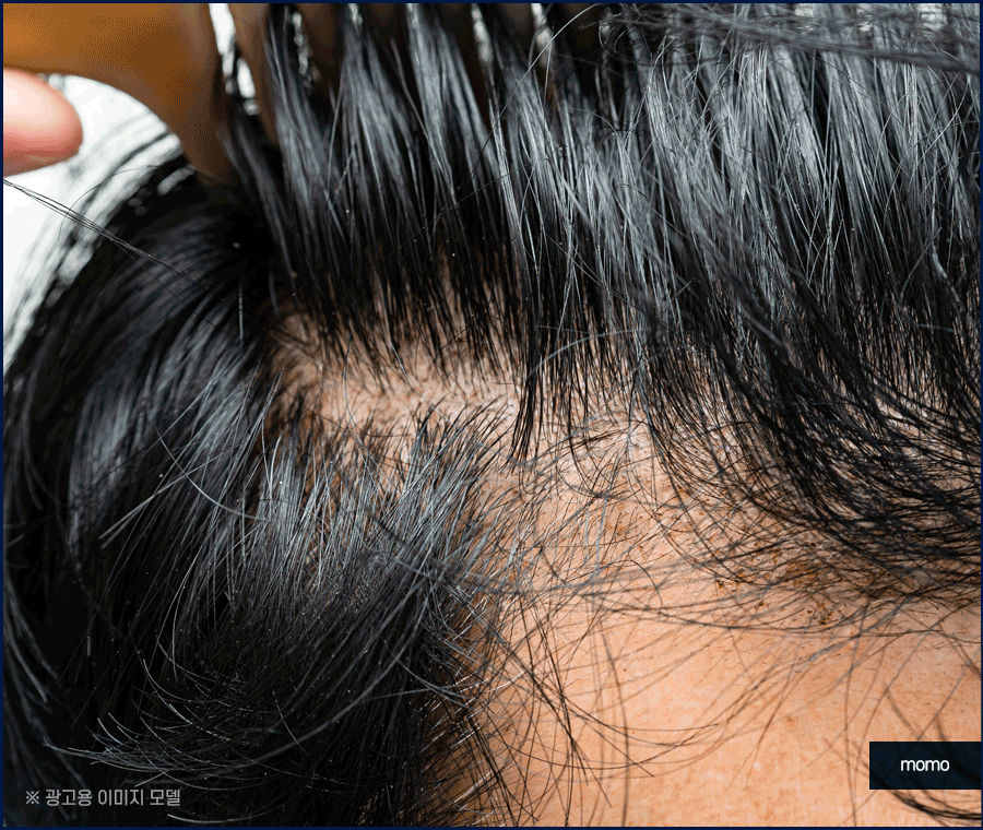 모발 굵어지는 효과적인 방법 3가지 알아보기 관련 이미지 6