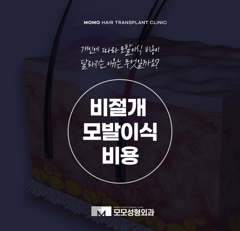 비절개 모발이식 비용 개인차를 고려해서 관련 이미지 1