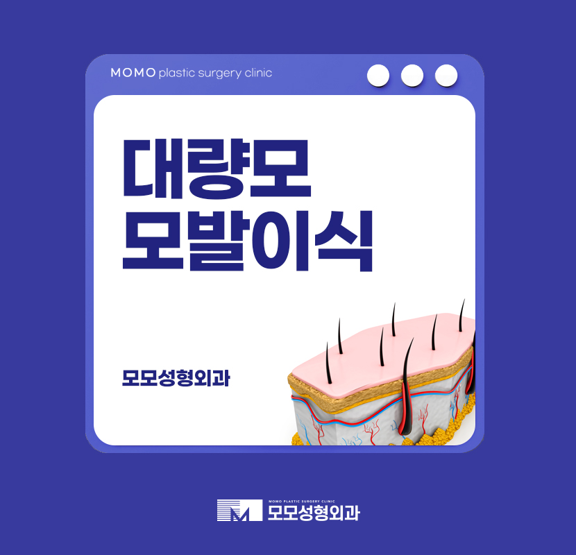 대량모모발이식 풍성함을 이뤄내는 관련 이미지 1