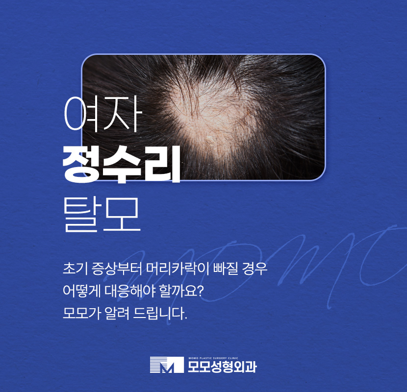 여자 정수리 탈모 초기 증상 및 머리카락빠짐 대응 방안 관련 이미지 1