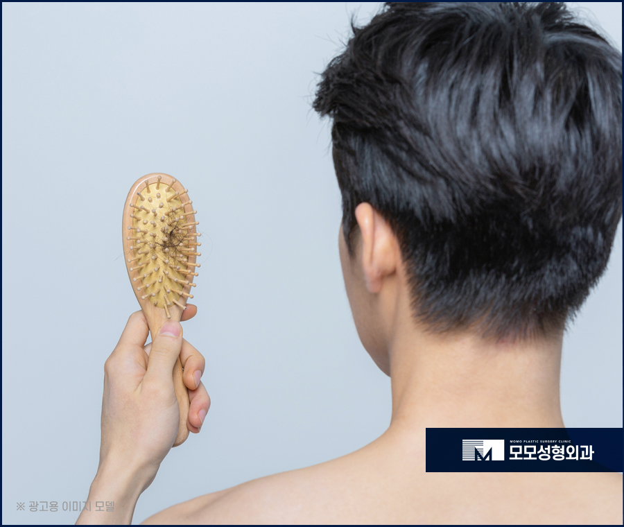 대량모발이식 드라마틱한 결과를 기대하며 관련 이미지 4