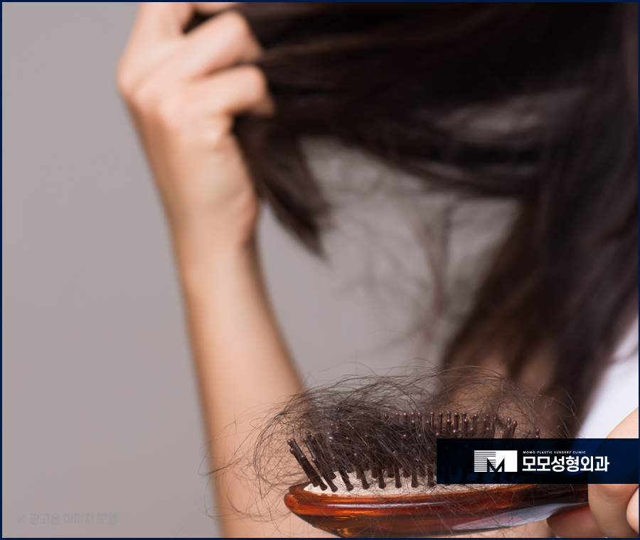 출산후 탈모 언제까지 지속되는지 여부와 개선 방안 관련 이미지 5