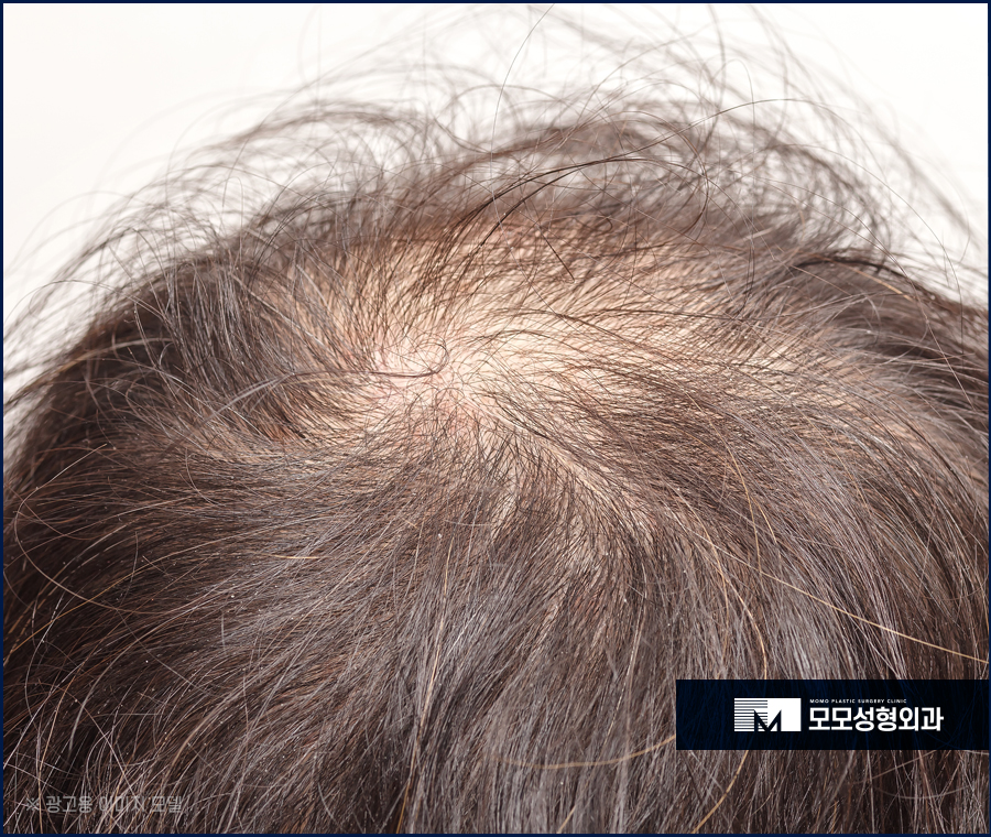 머리안말리고자면 어떤 문제들이 생겨날까 관련 이미지 6