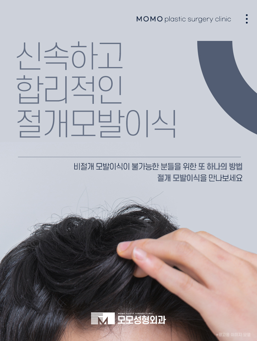 압구정모발이식 촘촘하게 채워지는 관련 이미지 4