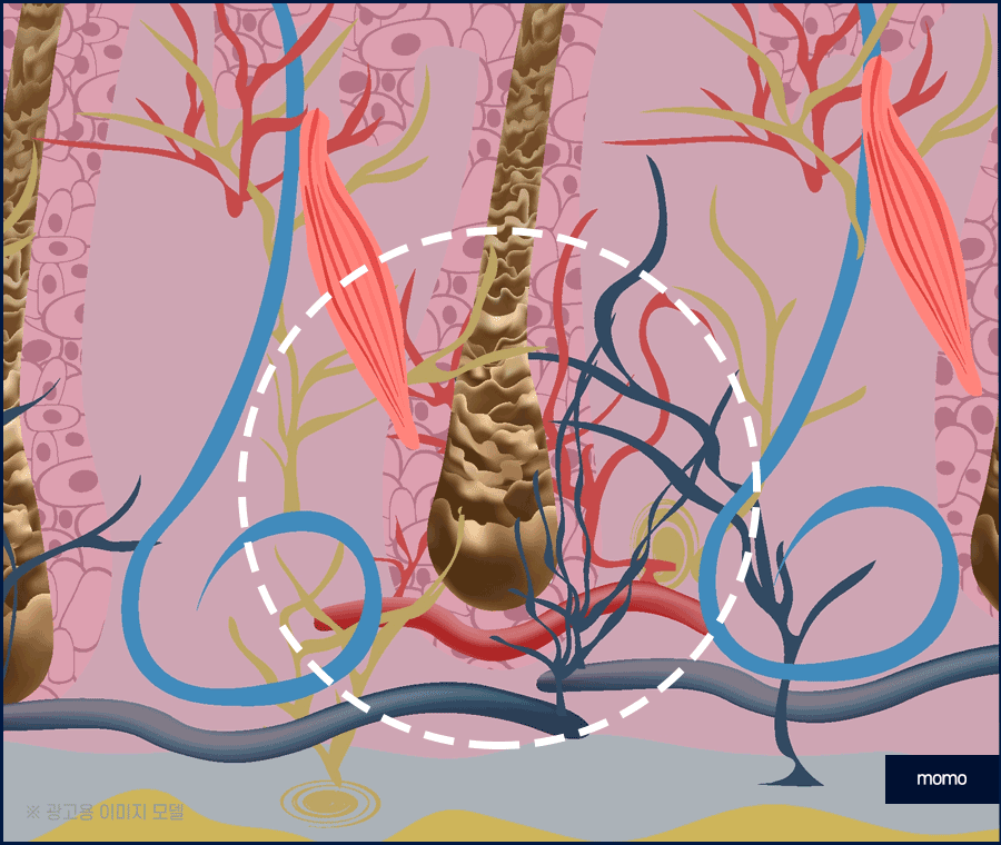 모발이식 3000모 비용 차이나는 이유 및 방법 관련 이미지 6