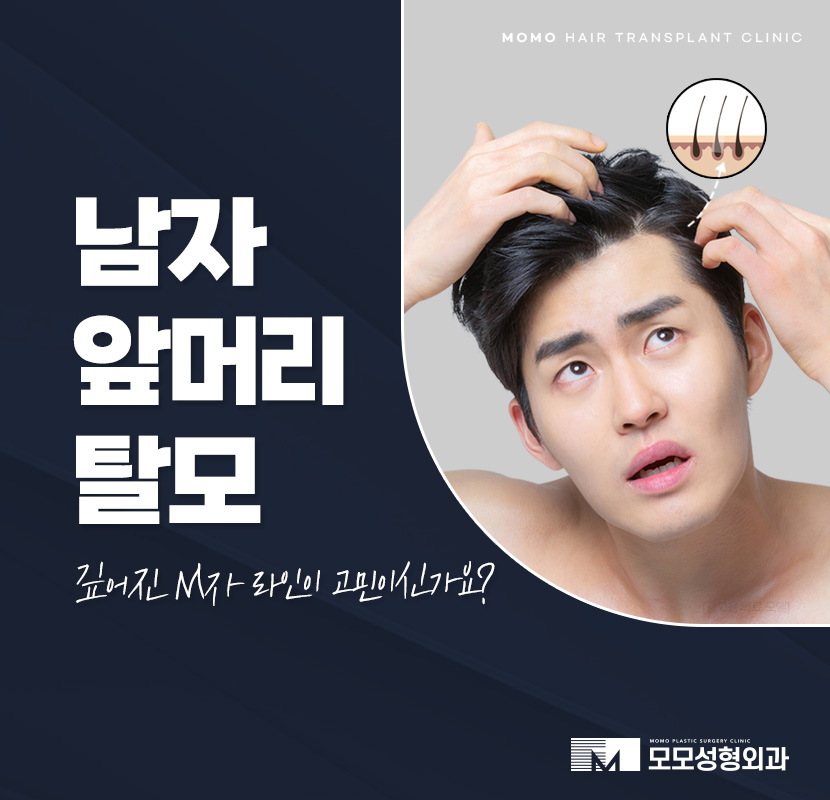 남자 앞머리 탈모 M자 라인 깊어짐이 보인다면 관련 이미지 1