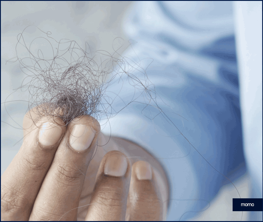 모발이식 금액 개인마다 차이가 나는 이유 관련 이미지 7