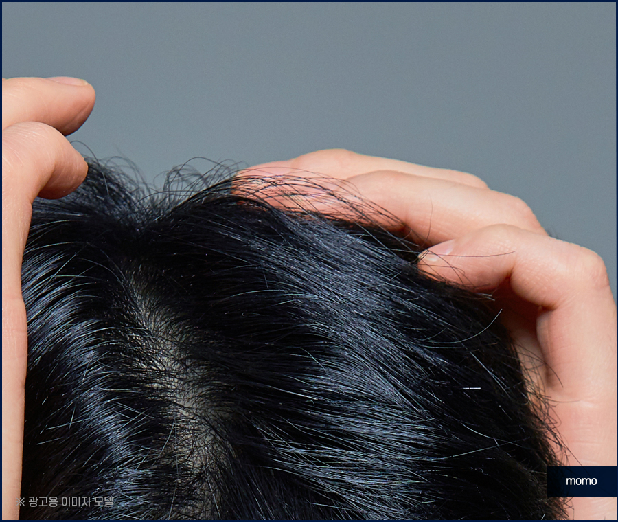 머리 간지러움 원인과 빠른 증상 해소를 위한 tip 관련 이미지 9